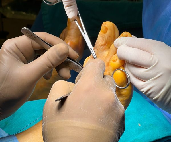 Foot Reconstruction - Doral Health & Wellness NY